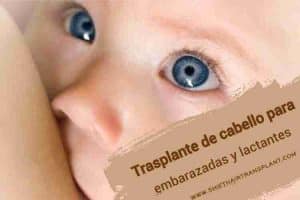 Trasplante de cabello para embarazadas y lactantes,