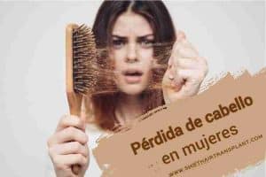 Pérdida de cabello en mujeres,
