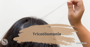 Imagen destacada del artículo Tricotilomanía de SHIFT Hair en Turquía Estambul