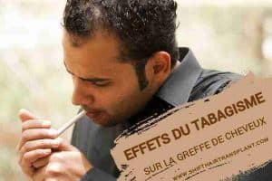 Effets du tabagisme sur la greffe de cheveux, Un gars chauve du Moyen-Orient en chemise grise allumant une cigarette.