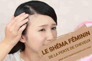 Le Schéma Féminin de la Perte de Cheveux, Une femme asiatique regardant ses cheveux manqués à travers le miroir de la main rose.