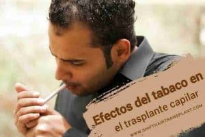 Efectos del tabaco en el trasplante capilar, Un tipo calvo de Oriente Medio en camisa gris enciende un cigarrillo.