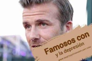 Famosos con trasplante capilar, David Beckham haciendo un reportaje en la calle.