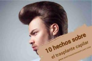 Datos del trasplante de cabello, un corte de pelo de hombre antiguo sobre un fondo azul claro.