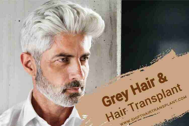 Grey Hair Transplant | what you don't know about Grey Hair Transplant