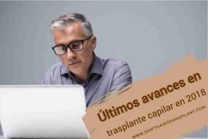 2018 Trasplante capilar últimos avances,
