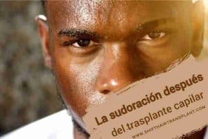 La sudoración después del trasplante capilar, imagen principal del artículo del blog.