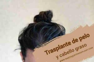 Trasplante de cabello graso, cabello graso de un hombre sobre un fondo amarillento.