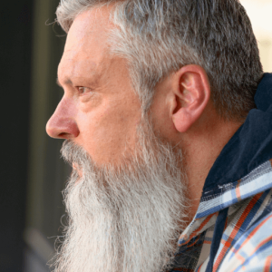 La greffe de cheveux sur cicatrice est une option pour couvrir les cicatrices de la tête, de la barbe et des sourcils.