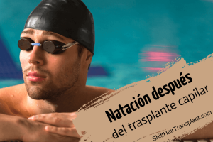 Natación después del trasplante capilar, imagen principal del artículo del blog.
