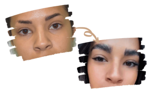 une femme avant et après la greffe de sourcils en Turquie Istanbul avec la greffe de cheveux Shift