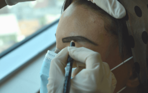 Greffe de sourcils en Turquie avec greffe de cheveux Shift à Istanbul Turquie