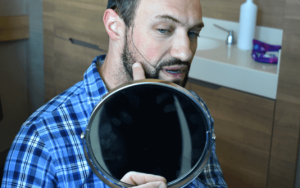 Greffe de barbe à Istanbul par SHIFT Hair Transplant Clinic Turquie