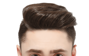 Le bienfait de cheveux en or par SHIFT Greffe de cheveux à Istanbul