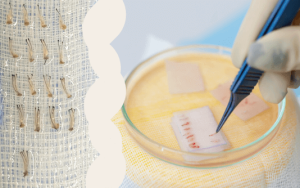 Greffe de cheveux Smart Selection par SHIFT Hair Transplant à Istanbul