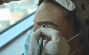 Trasplante de cejas en SHIFT