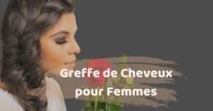 Greffe de cheveux pour les femmes en Turquie avec SHIFT Greffe de Cheveux à Istanbul 1