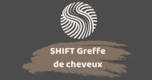 Le site de SHIFT Greffe de Cheveux 1