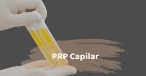 PRP Capilar en Turquía con SHIFT Trasplante Capilar en Estambul 1