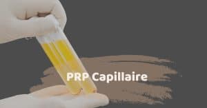 PRP Capillaire en Turquie avec SHIFT Greffe de Cheveux à Istanbul 1