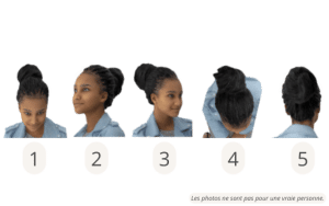 Les positions de tête pour une consultation en ligne de greffe de cheveux Afro pour les femmes en Turquie 1