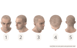 Posiciones de la cabeza para una consulta de micropigmentación en línea con SHIFT 1