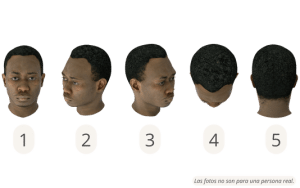 Posiciones de la cabeza para una consulta en línea de trasplante de cabello Afro en Estambul 1