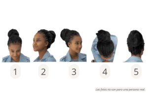 Posiciones de la cabeza para una consulta en línea de trasplante de cabello Afro para mujeres en Estambul 1