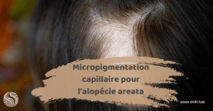 Micropigmentation capillaire pour l'alopécie areata