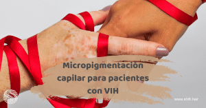 Micropigmentación capilar para pacientes con VIH 3