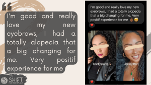 Afro Eyebrow Transplant Review with SHIFT Hair in Turkey 02 3