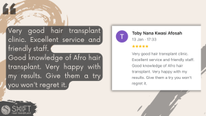 Afro Hair Transplant Review with SHIFT Hair in Turkey 11 3