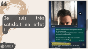 Avis de greffe de cheveux avec SHIFT Hair en Turquie 05 3