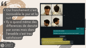 Examen de la greffe de cheveux afro avec SHIFT Hair en Turquie 07 3
