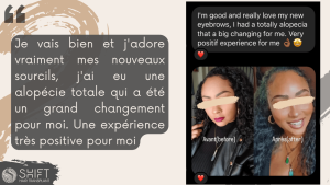 Examen de la greffe de sourcils afro avec SHIFT Hair en Turquie 02 3