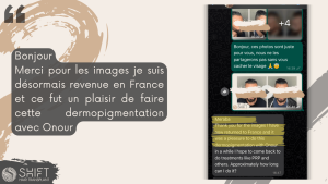 Examen de la micropigmentation du cuir chevelu avec SHIFT Hair en Turquie 05 3