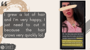 Eyebrow Transplant Review with SHIFT Hair in Turkey 07 3
