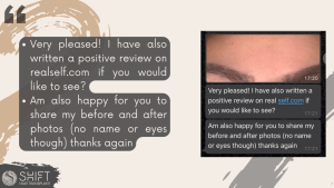 Eyebrow Transplant Review with SHIFT Hair in Turkey 08 3