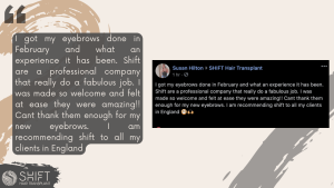 Eyebrow Transplant Review with SHIFT Hair in Turkey 12 3
