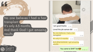 Hair Transplant Review with SHIFT Hair in Turkey 03 3