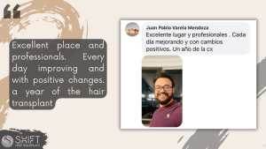 Hair Transplant Review with SHIFT Hair in Turkey 13 3