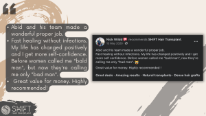Hair Transplant Review with SHIFT Hair in Turkey 20 3