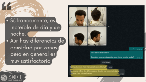 Reseña de trasplante capilar afro con SHIFT Hair en Turquía 11 3
