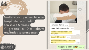 Reseña de trasplante capilar con SHIFT Hair en Turquía 03 3