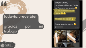 Reseña de trasplante capilar con SHIFT Hair en Turquía 08 3