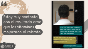 Reseña de trasplante capilar con SHIFT Hair en Turquía 14 3