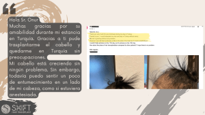 Reseña de trasplante capilar para mujeres con SHIFT Hair en Turquía 03 3