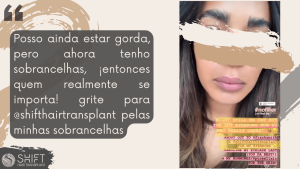 Reseña de trasplante de cejas afro con SHIFT Hair en Turquía 01 3