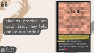 Reseña de trasplante de cejas con SHIFT Hair en Turquía 01 3