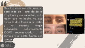 Reseña de trasplante de cejas con SHIFT Hair en Turquía 03 3